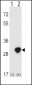 TPI1 Antibody (N-term)