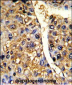 TUFM Antibody (N-term)