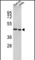 TUFM Antibody (N-term)