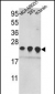 PRDX2 Antibody (C-term)