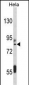 IMMT Antibody (C-term)