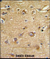 IMMT Antibody (Center)