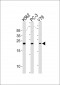 GSTP1 Antibody (C-term)