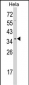 STRAP Antibody (C-term)