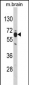 PHGDH Antibody (N-term)