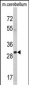 YWHAG Antibody (Center)