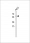 PAX3 Antibody (N-term)