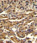 ABCG1 Antibody (Center)