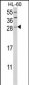 GZMB Antibody (C-term)