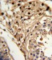 KLF6 Antibody (C-term)