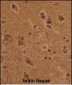 CTDP1 Antibody (N-term)