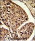 PSME2 Antibody (Center)