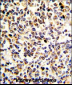 KRT10 Antibody (N-term)