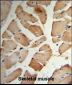 MVD Antibody (Center)