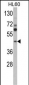 MVD Antibody (Center)