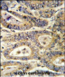 IGFBP6 Antibody (C-term)
