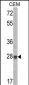 IGFBP6 Antibody (C-term)