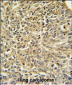 Merlin Antibody (N-term)