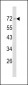 Merlin Antibody (N-term)