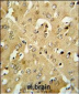 CRHR2 Antibody (Center)