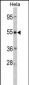 CRHR2 Antibody (Center)