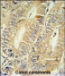 HPGD Antibody (C-term)