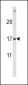 FSHB Antibody (Center T70)