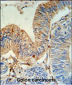 HLA-DRA Antibody (N-term)