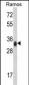 HLA-DRA Antibody (N-term)