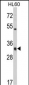 HLA-DRA Antibody (C-term)