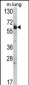 Hsp 60 Antibody (N-term)