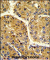TF Antibody (C-term)