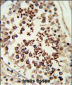 SMAC Antibody (C-term)