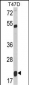 SMAC Antibody (C-term)