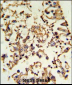 PRKACA Antibody (N-term K82)