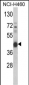 PRKACA Antibody (N-term K82)