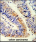 RELA Antibody (N-term)