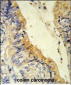 ACADM Antibody (Center)