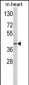 ACADM Antibody (Center)