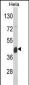 ASS Antibody (Center)