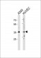 HOXB5 Antibody (C-term)