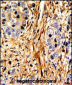 LAMB2 Antibody (C-term)
