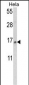 SNRPD2 Antibody (N-term)