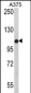 TCPR1 Antibody (N-term)