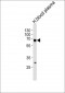 FGA Antibody (N-term)