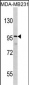 DLGAP1 Antibody (N-term)