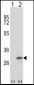 FHL1 Antibody (C-term)