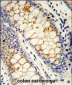 SFRS1 Antibody (C-term)