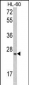 SFRS1 Antibody (C-term)