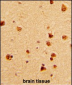 KHSRP Antibody (N-term)